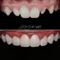 cosmetic dentistry image