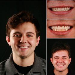 cosmetic dentistry image